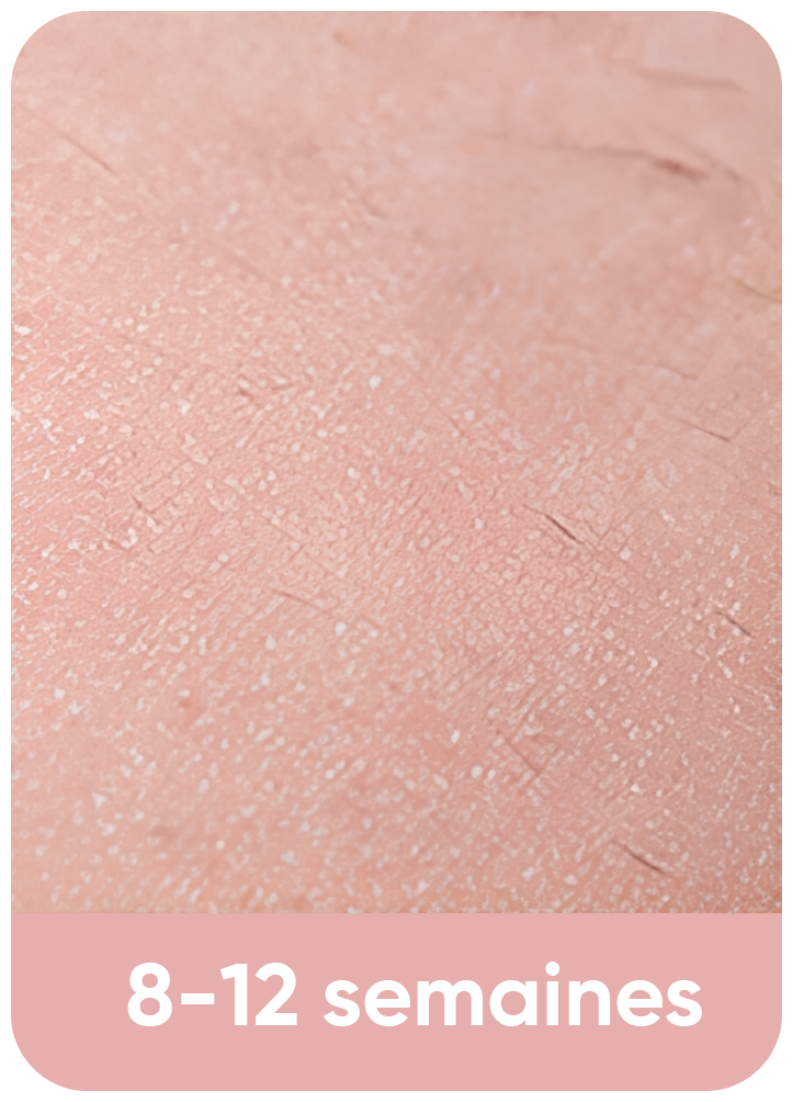 Avis-Epilateur-lumiere-pulsee-GUERIDA