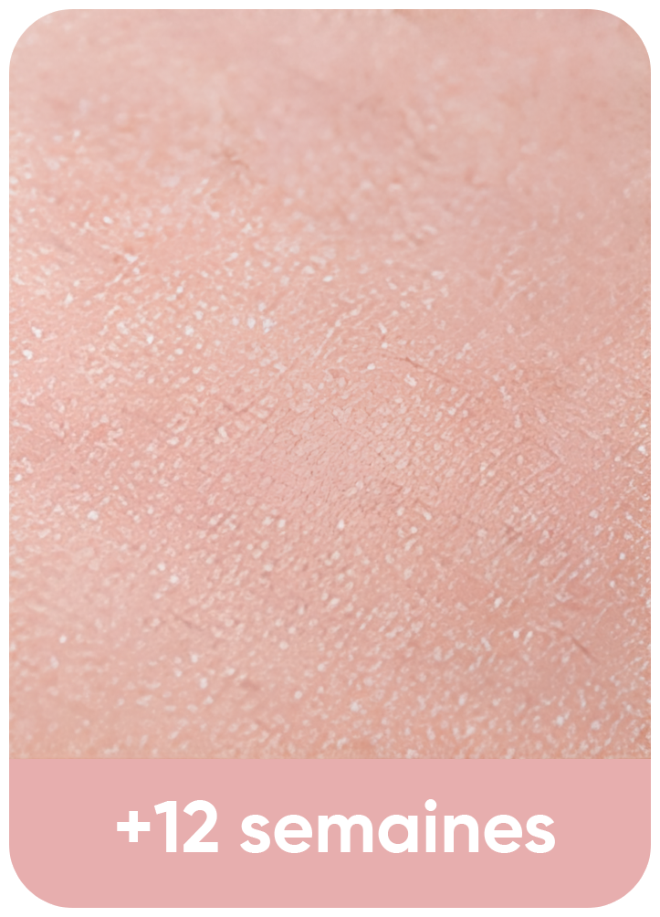 Avis-Epilateur-lumiere-pulsee-IPL GUERIDA